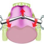 Un diagrama que muestra el funcionamiento de las embocaduras para caballos como los filete dos piezas